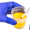 Urine